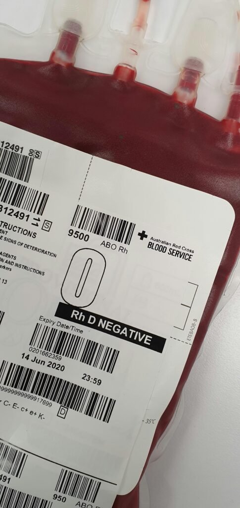 pexels-photo-4531319-4531319 Detailed view of a blood bag labeled Rh D Negative for medical donation purposes.
